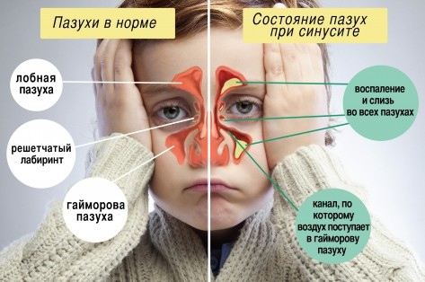 b079983ea9.jpeg