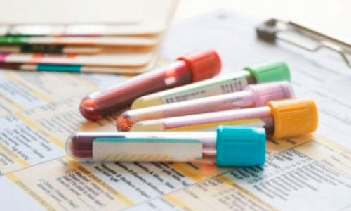 Новый-тест-позволит-определить-риск-выкидыша-на-раннем-сроке-беременности сроке беременности