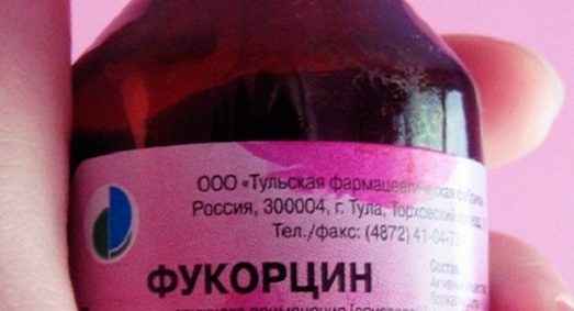Чем можно смыть фукорцин?