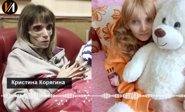 С 17 кг в светлое будущее: как сейчас живет Кристина Корягина с диагнозом анорексии