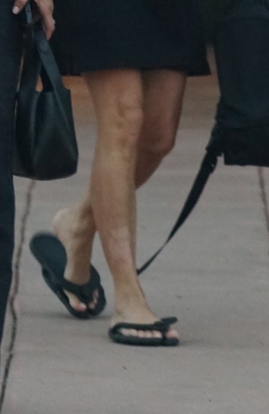 Изъеденные псориазом ноги — эти фото Ким Кардашьян обнуляют ее безупречность