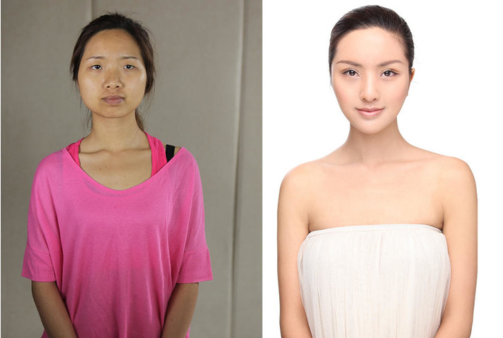 Китаянки до и после пластики