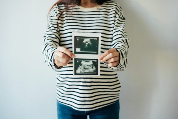 5 советов, которые облегчат вашу беременность