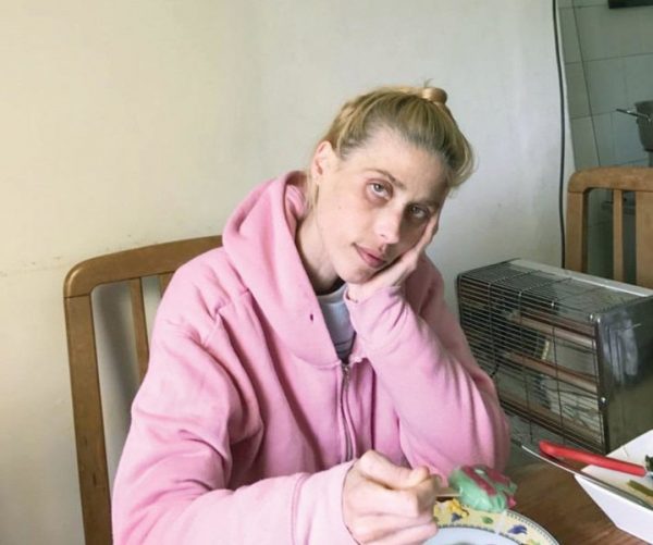 Седые волосы, кожа да кости: 35-летняя модель Карина Бауман умерла после критического похудения до 24 кг