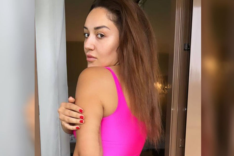 Блогерша Гоар Аветисян показала шрам на теле после подтяжки кожи