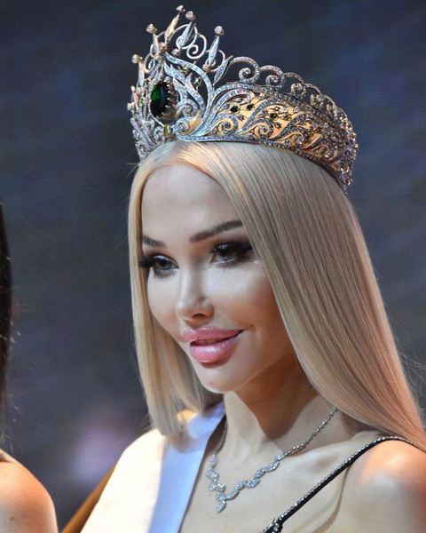 Найдены старые фото новой «Мисс Москвы» — как она выглядела, пока не изменилась до неузнаваемости