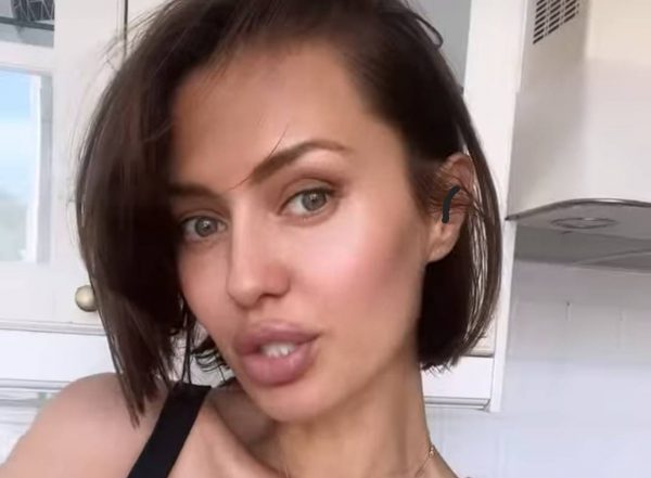 Викторию Боню уличили в новой пластике