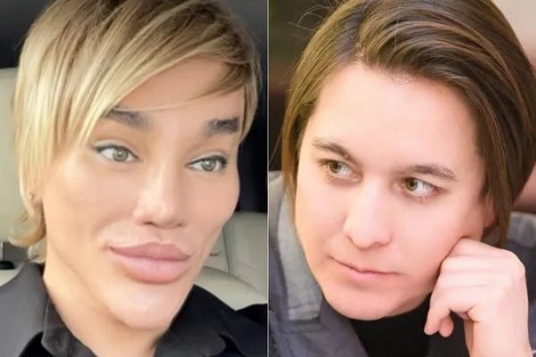 У Вдовина обнаружили инородное тело в ягодицах после операции у Хайдарова