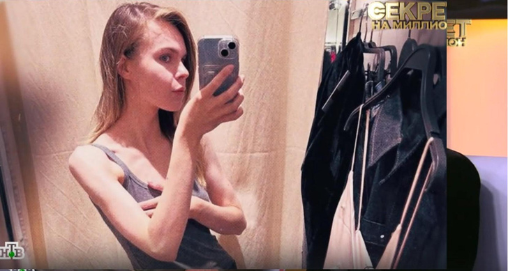 Страдающая от анорексии дочь Сергея Астахова пошла на поправку — она набрала 10 кг