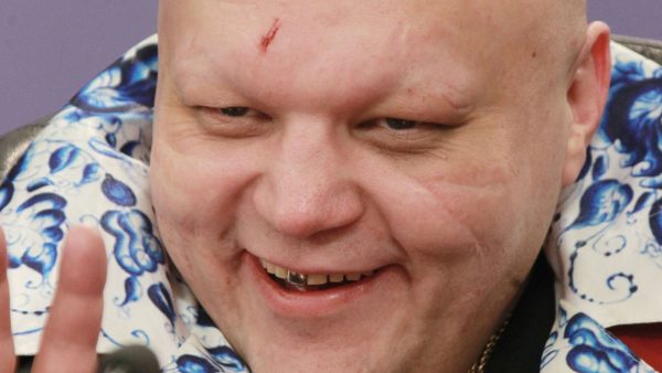 «Чуть не умер»: Барецкий рассказал о приеме жиросжигателей от Лерчек
