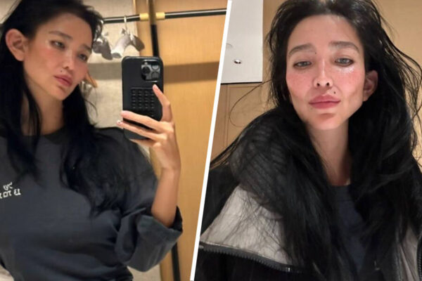 Жена Александра Цекало о пластике ушей: «Закончились теории»