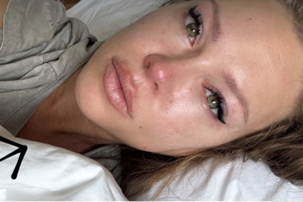 Рита Дакота рассказала о последствиях пластической операции: «Мрачный отекший урод»