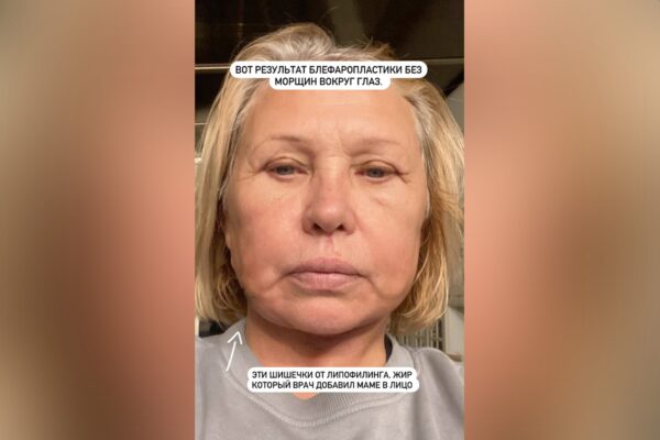 Виктория Боня показала мать после пластики по бартеру