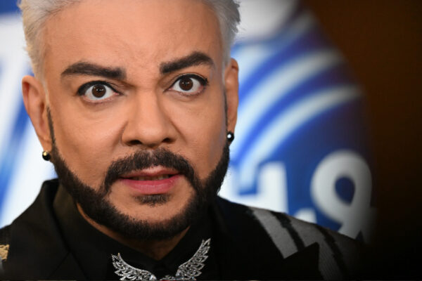 Диетолог Никитина допустила, что певец Киркоров сделал откачку жира