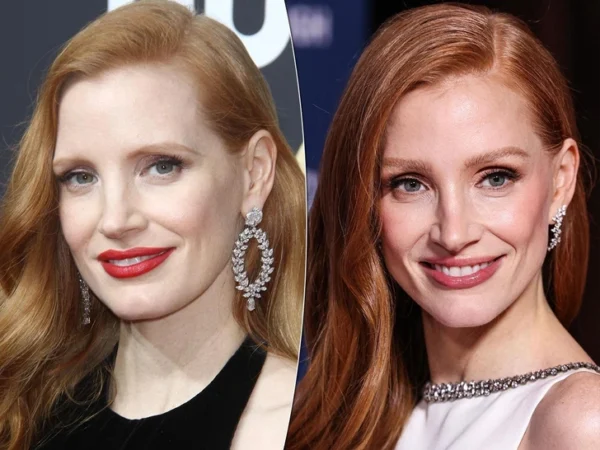 5 звездных примеров идеальной подтяжки лица — фото до и после