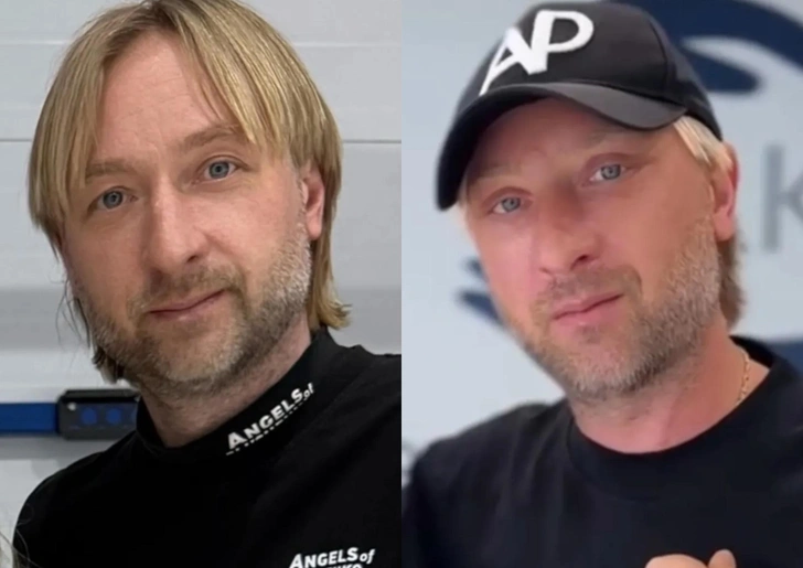 Евгений Плющенко до и после пластики 
